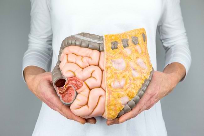 Kesehatan Usus dengan menjaga pola makan