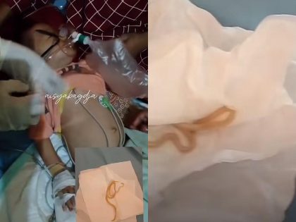 cacing gelang pada anak